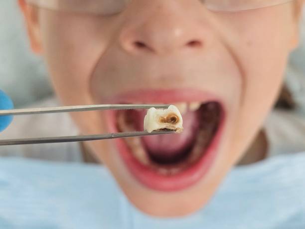 Best Pediatric Emergency Dentist in Fredericktown, OH